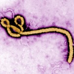 Ebola Virus